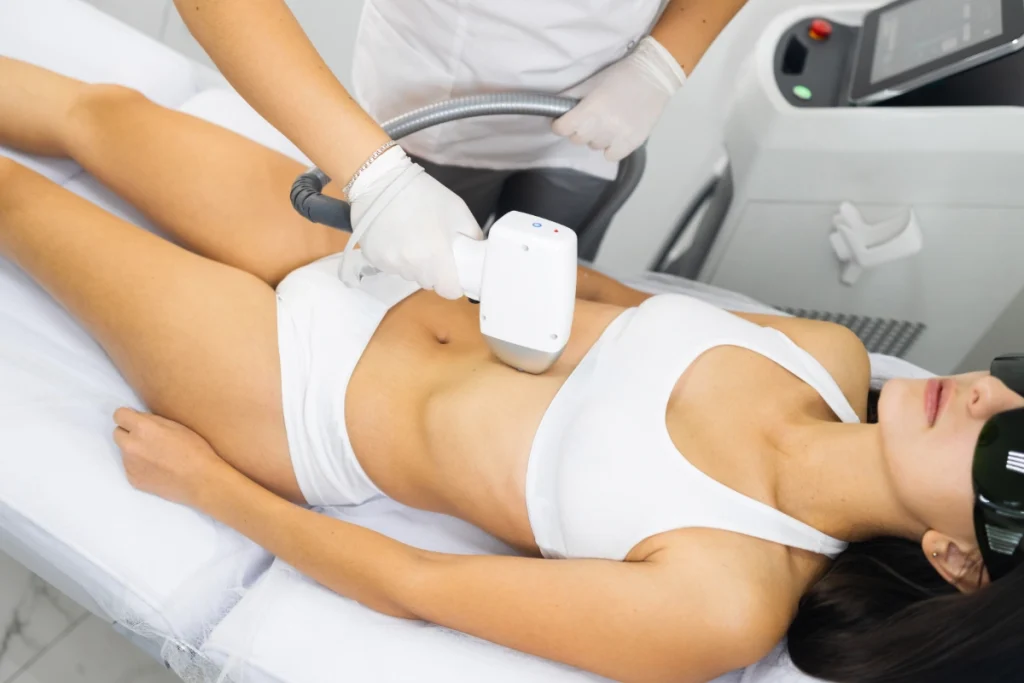 Woman On Laser Hair Removal Procedure 2024 10 20 19 05 47 Utc